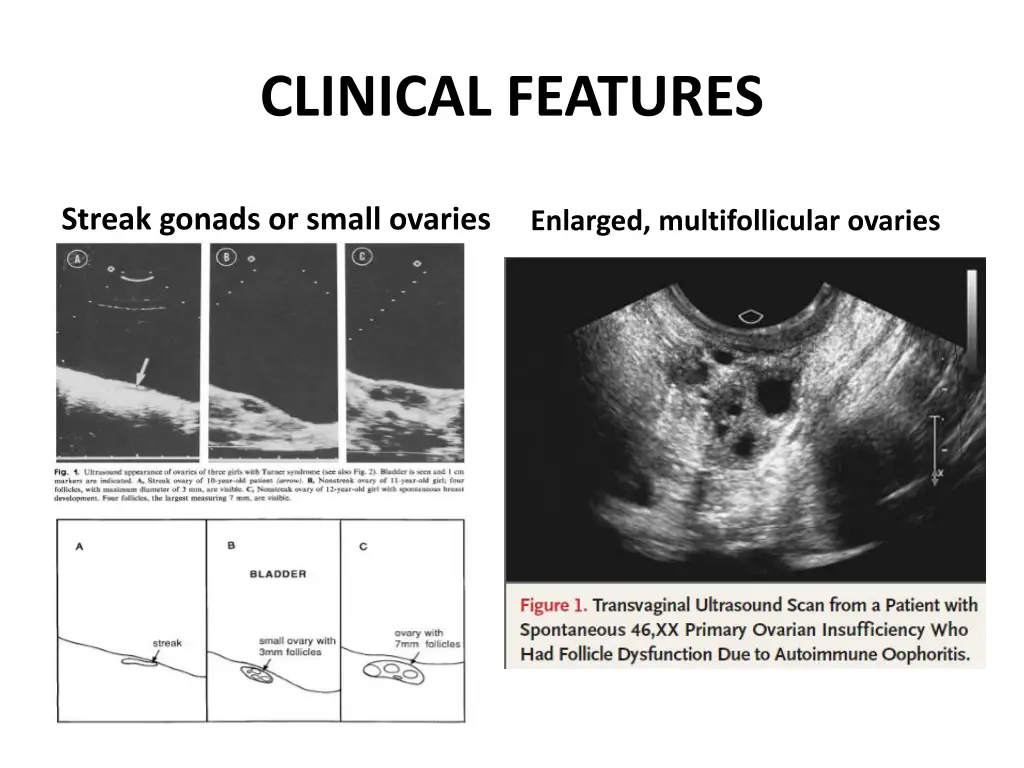 clinical features 5