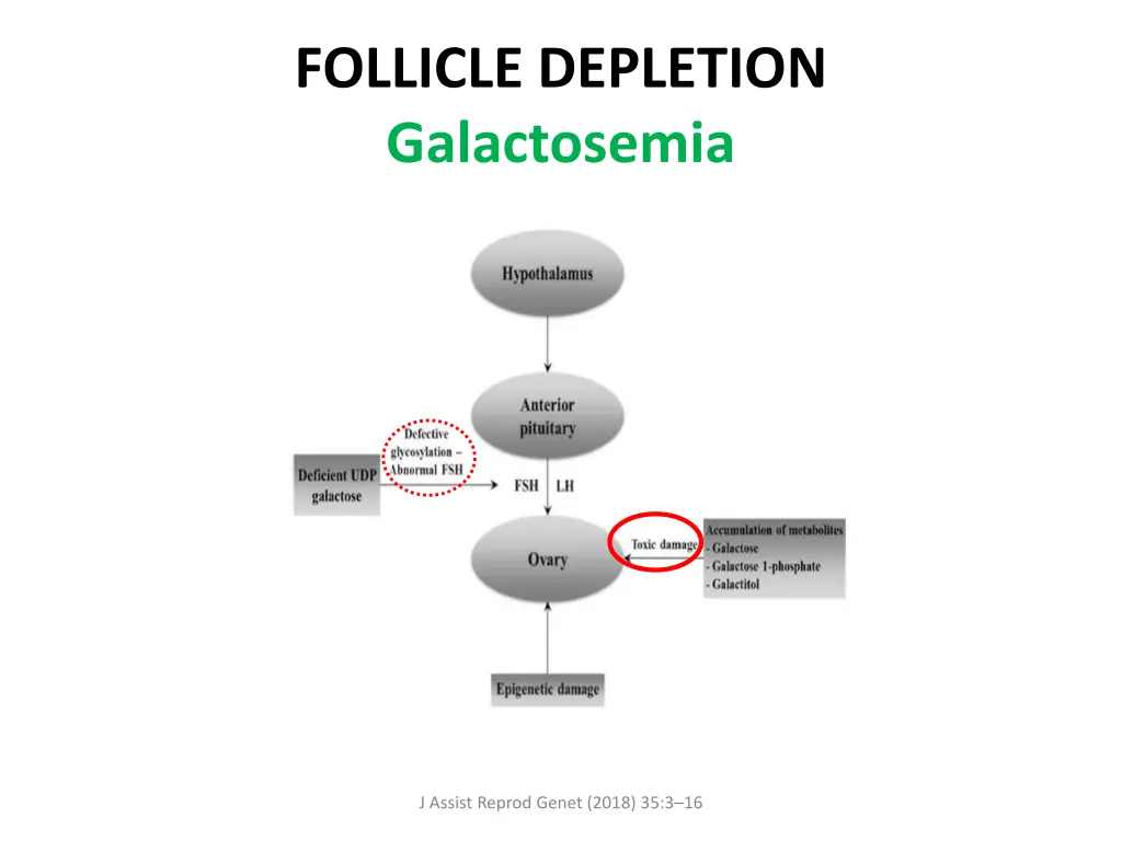 follicle depletion galactosemia 1