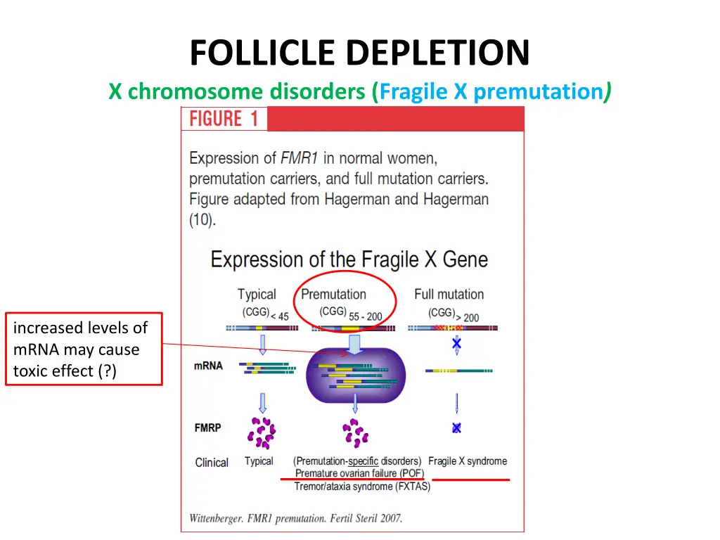 follicle depletion x chromosome disorders fragile 1