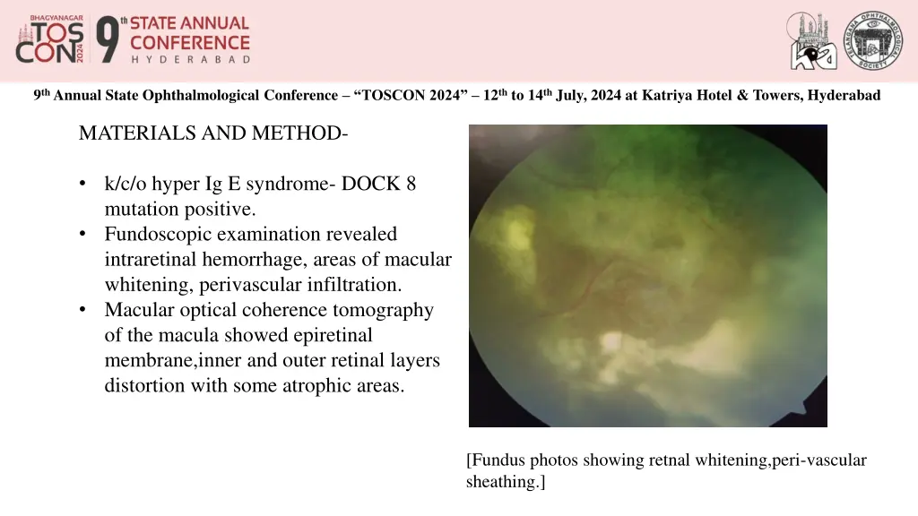 9 th annual state ophthalmological conference 2