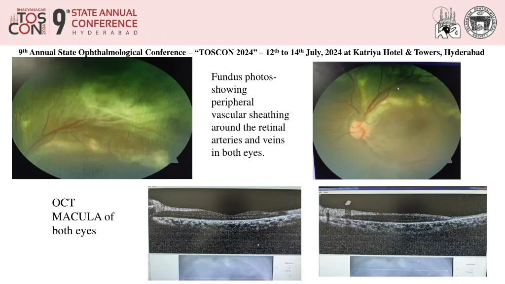 9 th annual state ophthalmological conference 3