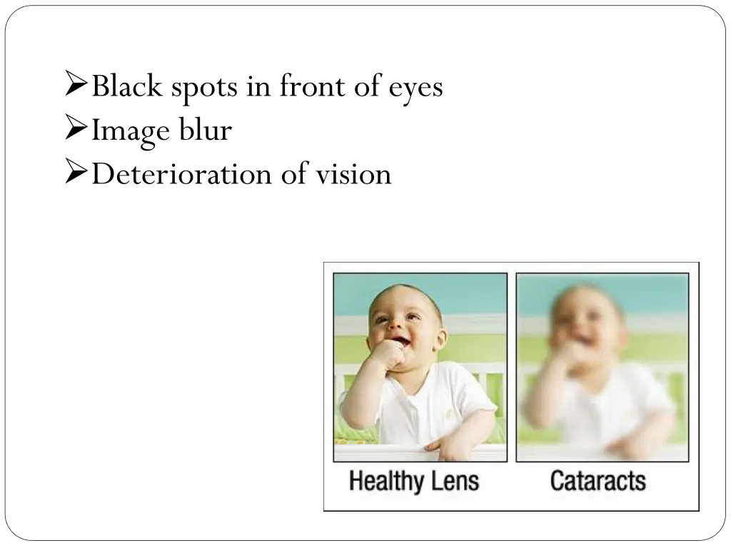 black spots in front of eyes image blur