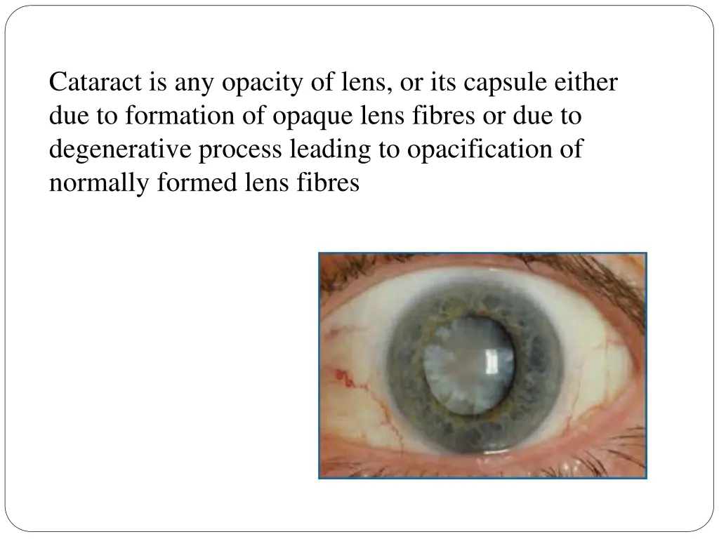 cataract is any opacity of lens or its capsule