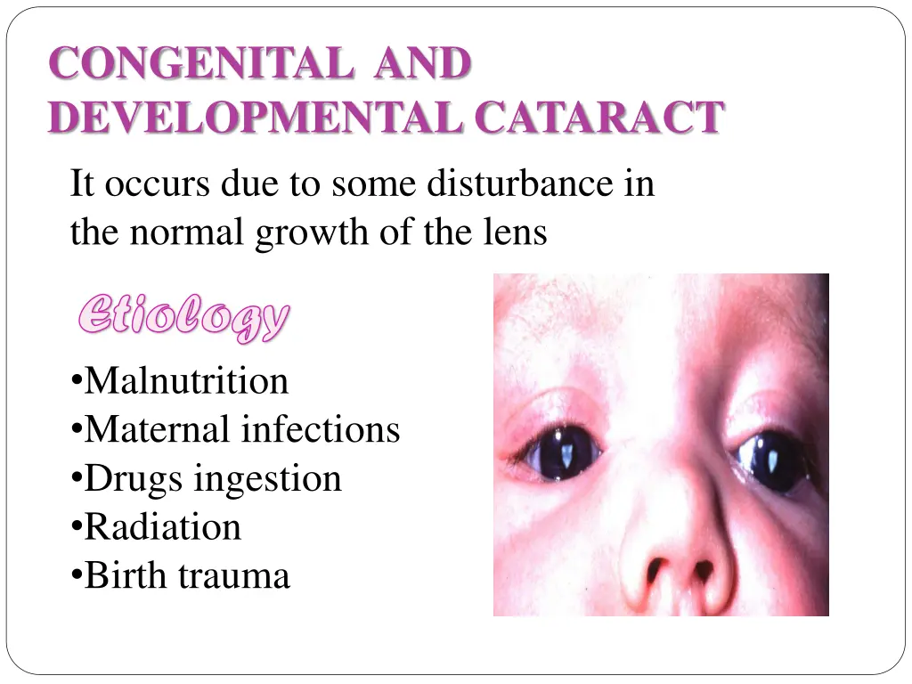 congenital and developmental cataract it occurs