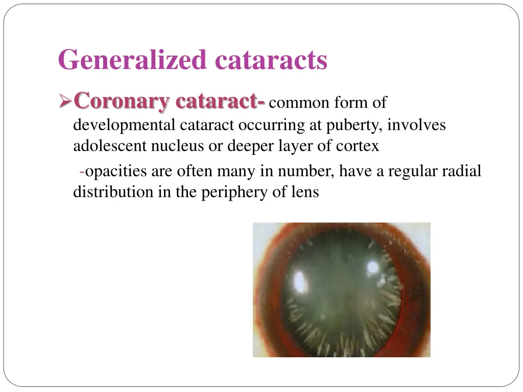 generalized cataracts