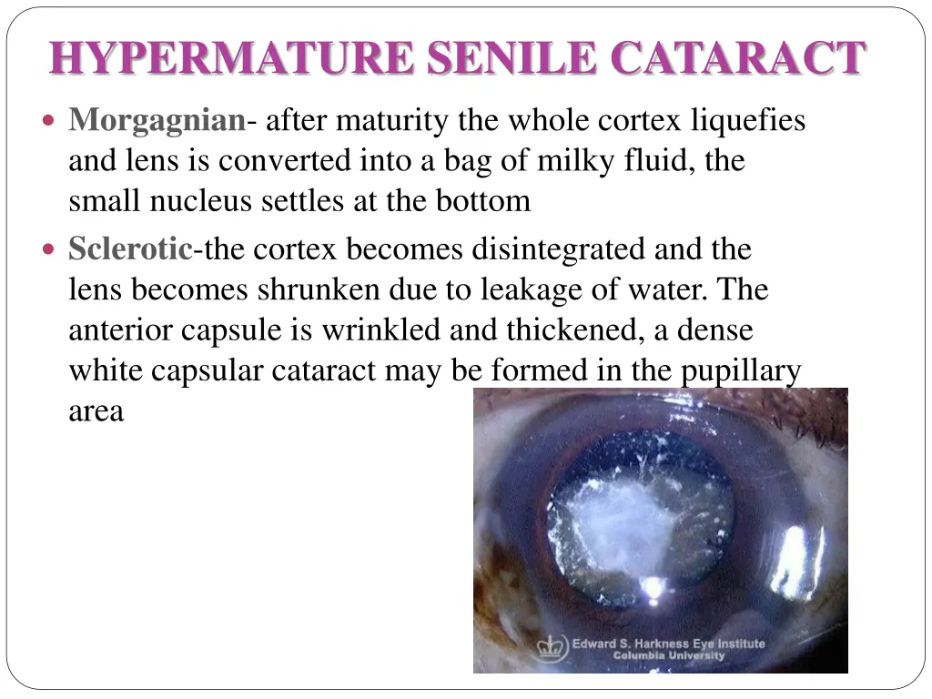 hypermature senile cataract