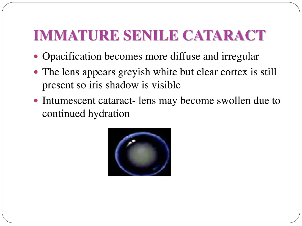 immature senile cataract