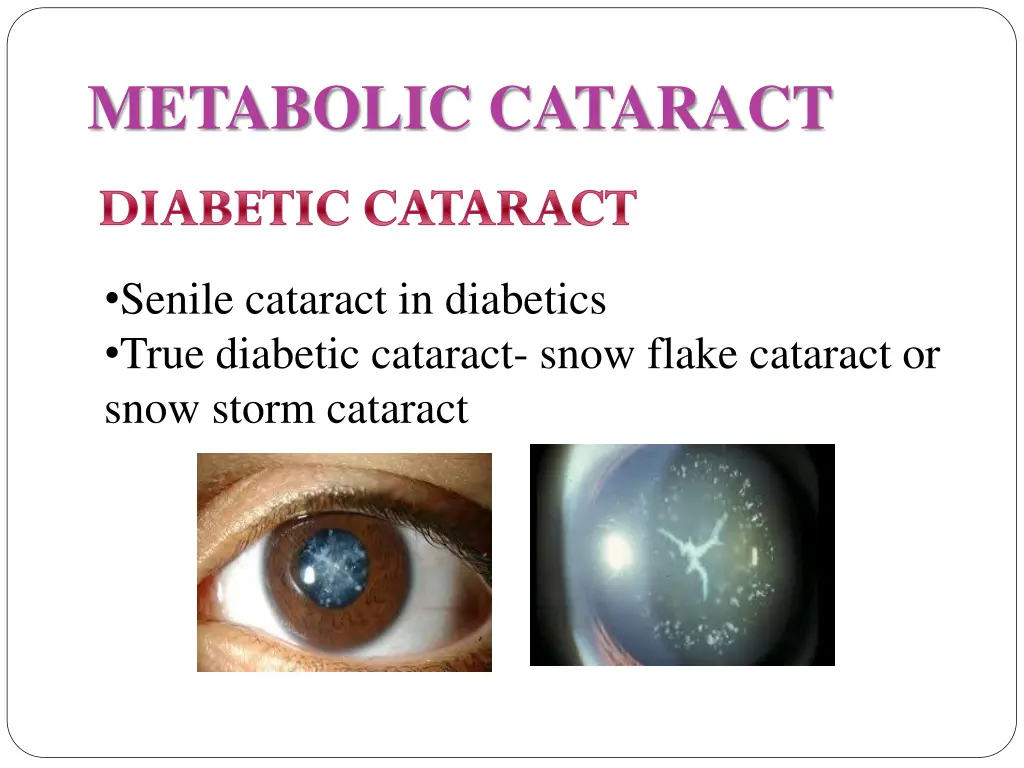 metabolic cataract