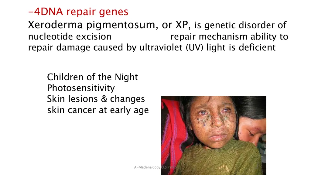 4dna repair genes xeroderma pigmentosum