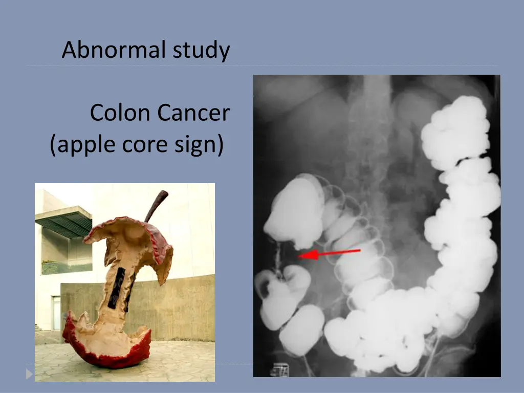 abnormal study