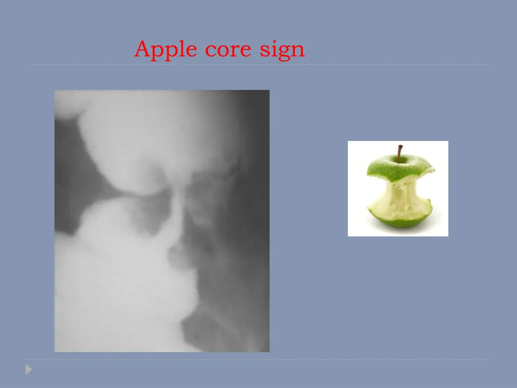 apple core sign