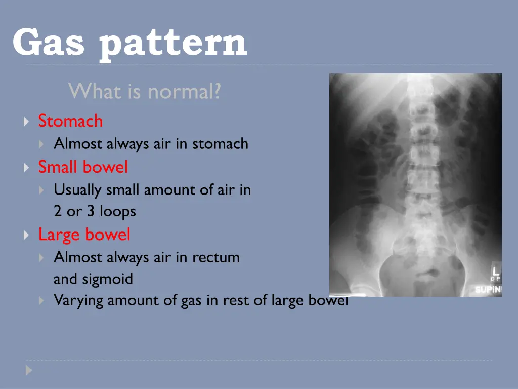 gas pattern