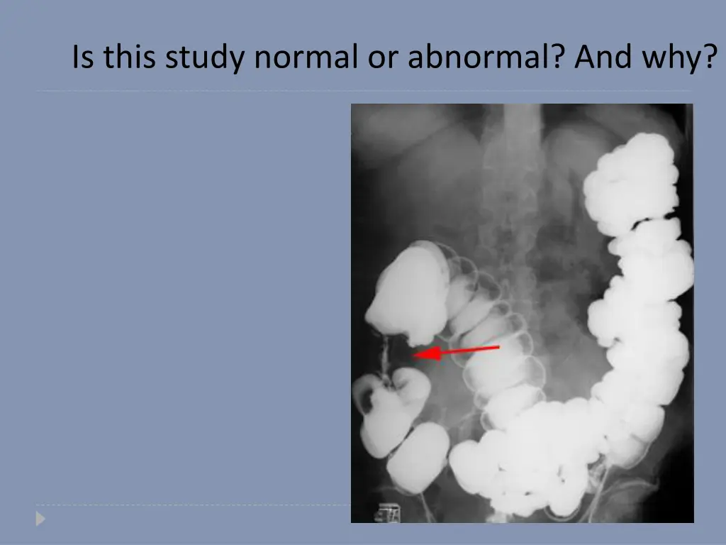 is this study normal or abnormal and why