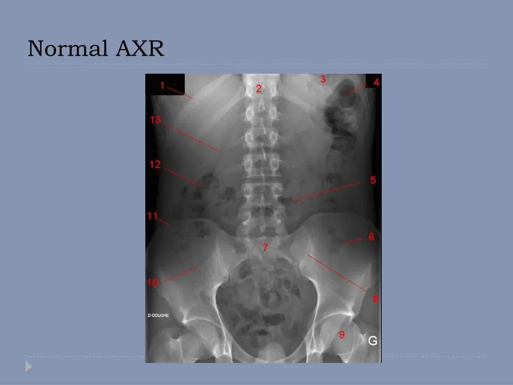 normal axr