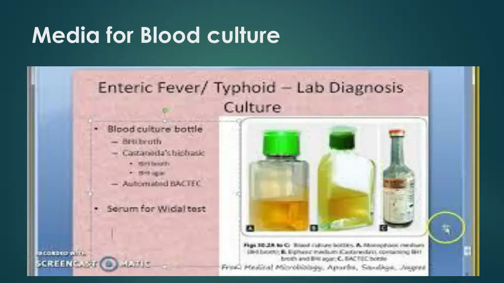 media for blood culture