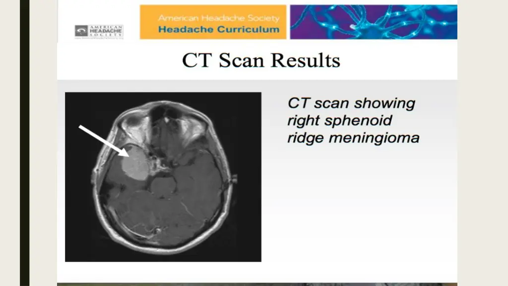 slide36