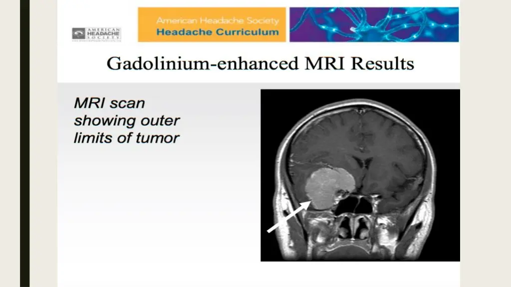 slide37