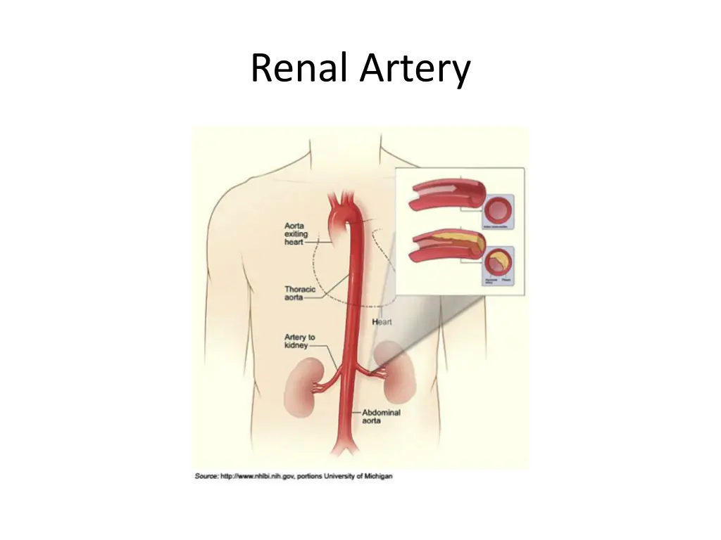 renal artery