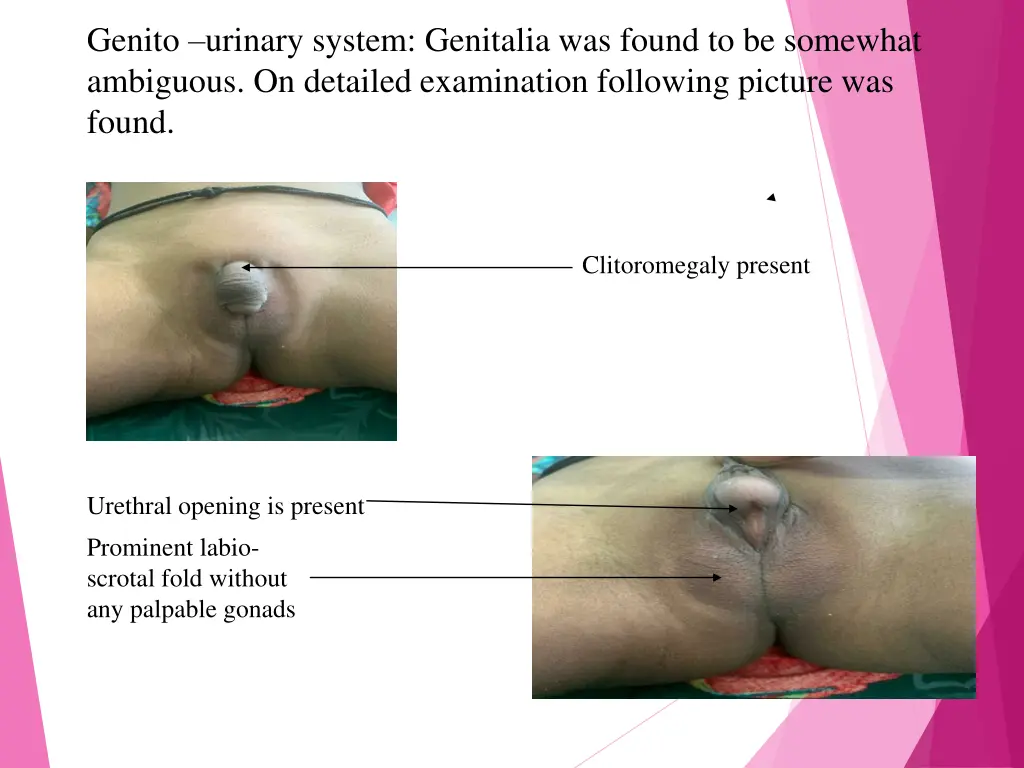 genito urinary system genitalia was found