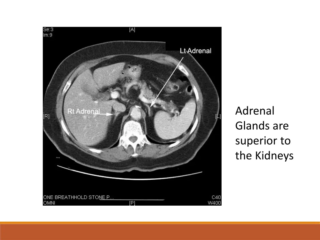 adrenal glands are superior to the kidneys