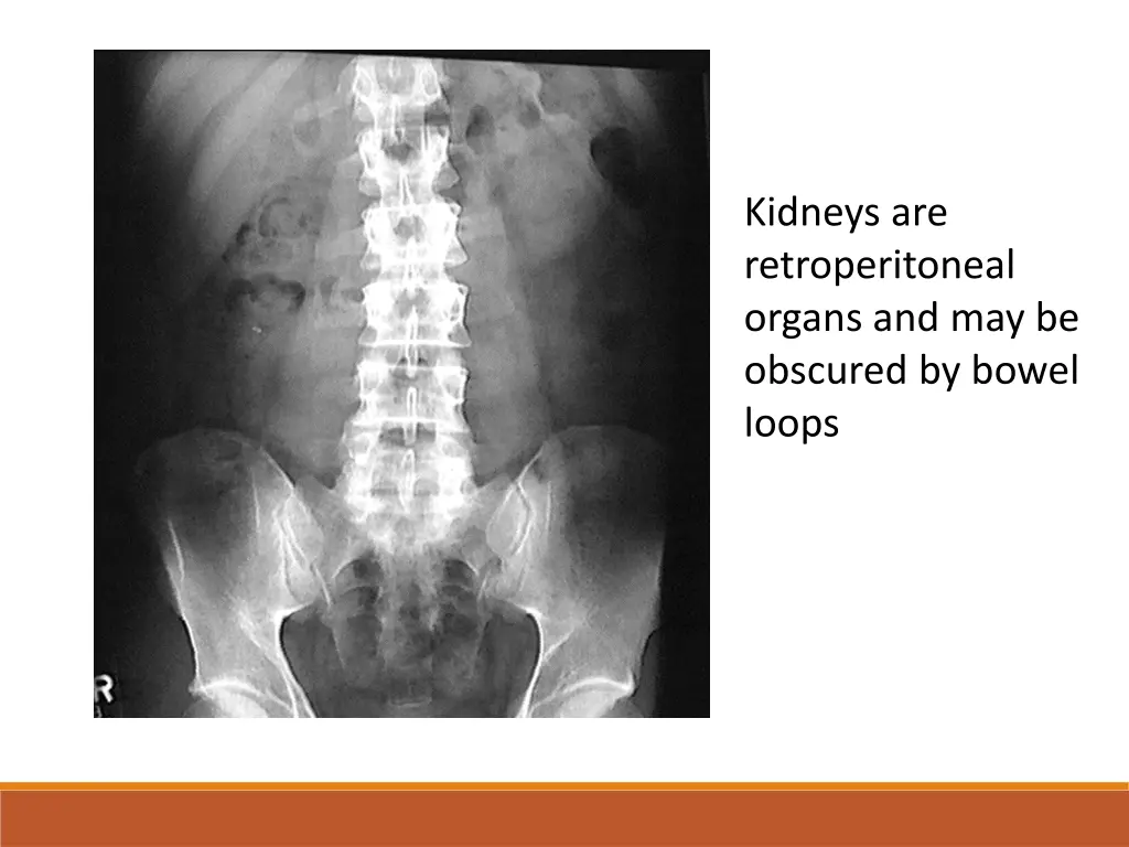 kidneys are retroperitoneal organs