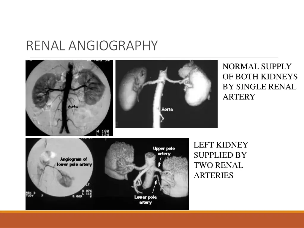 renal angiography