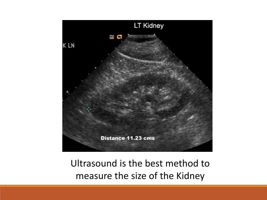 ultrasound is the best method to measure the size