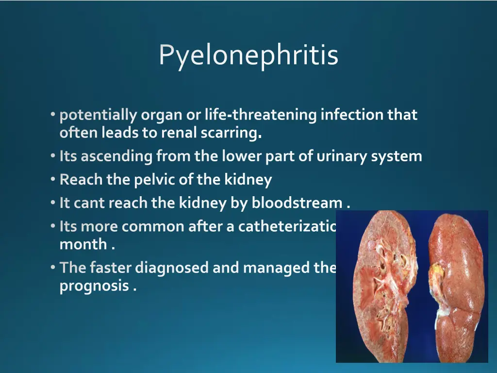 pyelonephritis