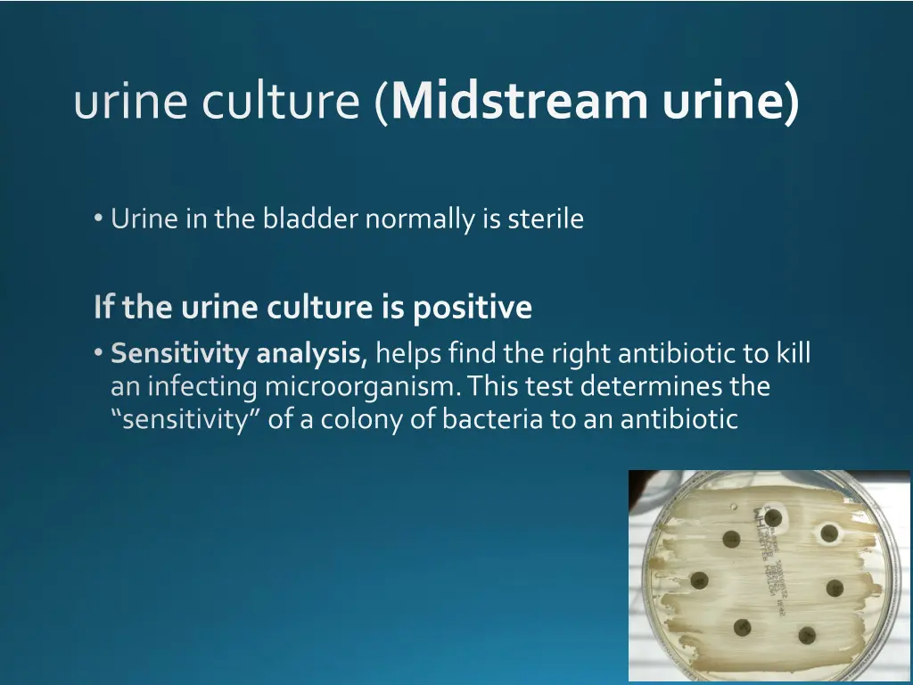 urine culture midstream urine