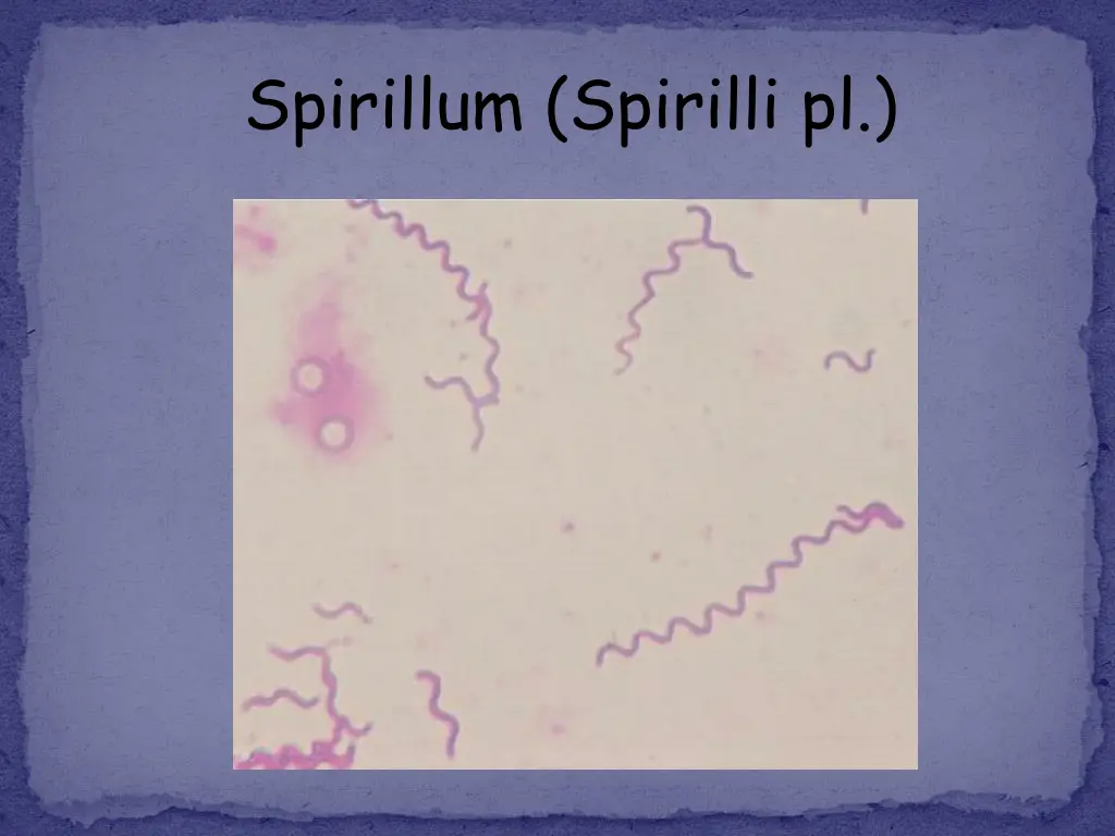 spirillum spirilli pl