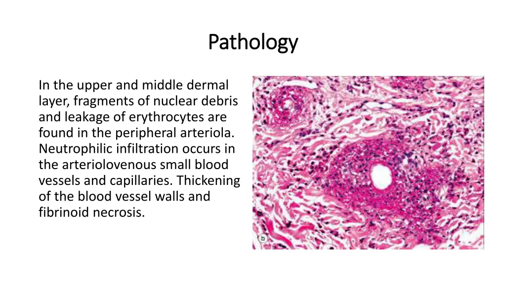 pathology pathology