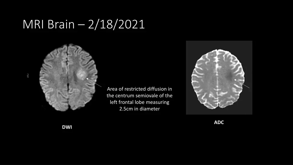 mri brain 2 18 2021