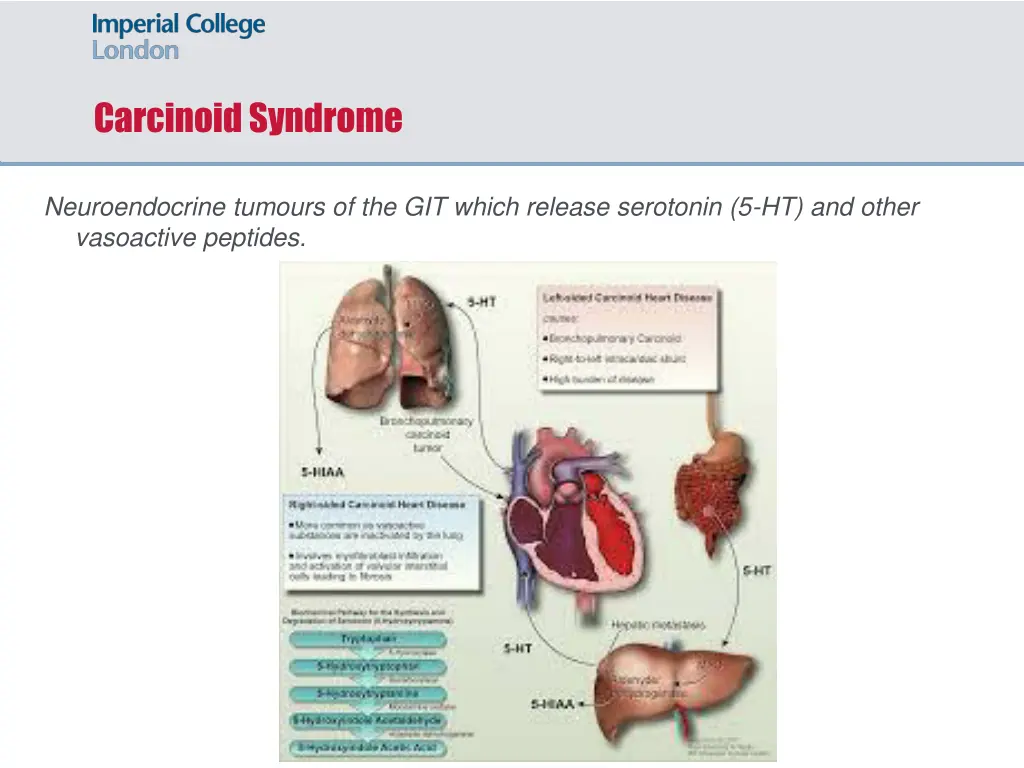 carcinoid syndrome