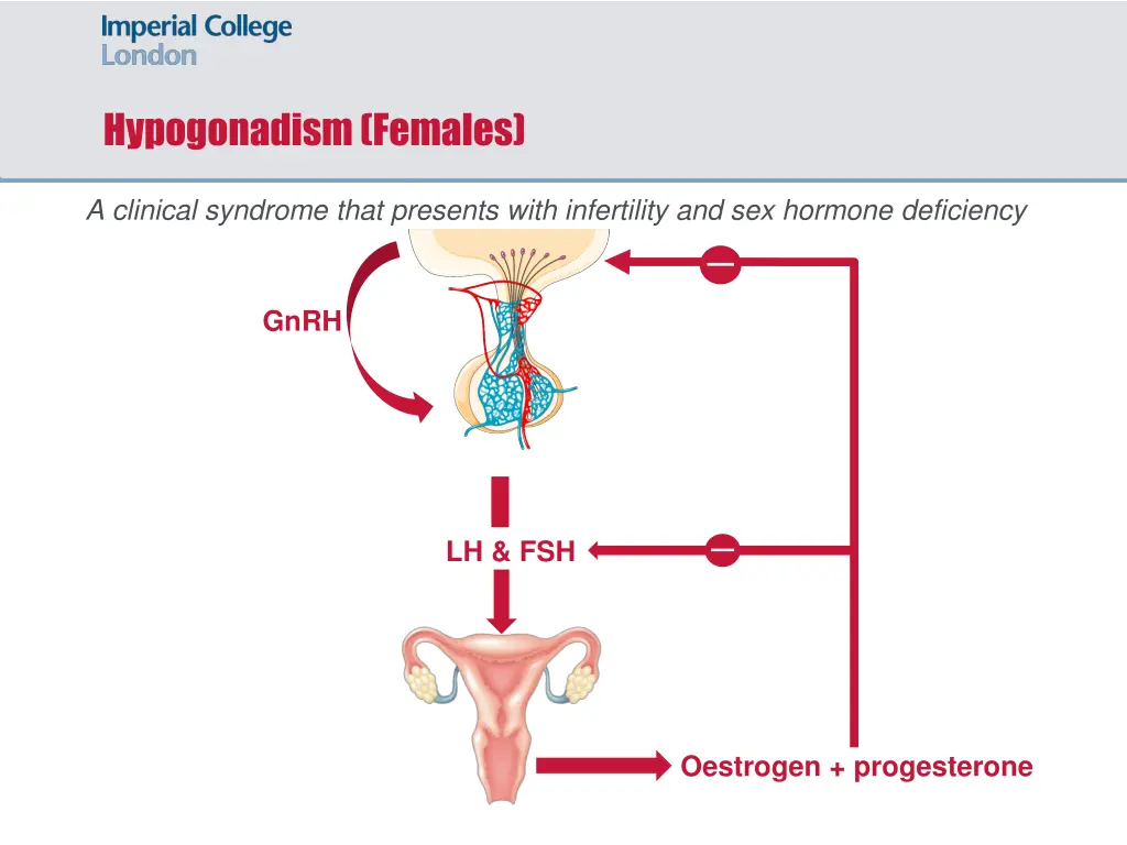 hypogonadism females 1