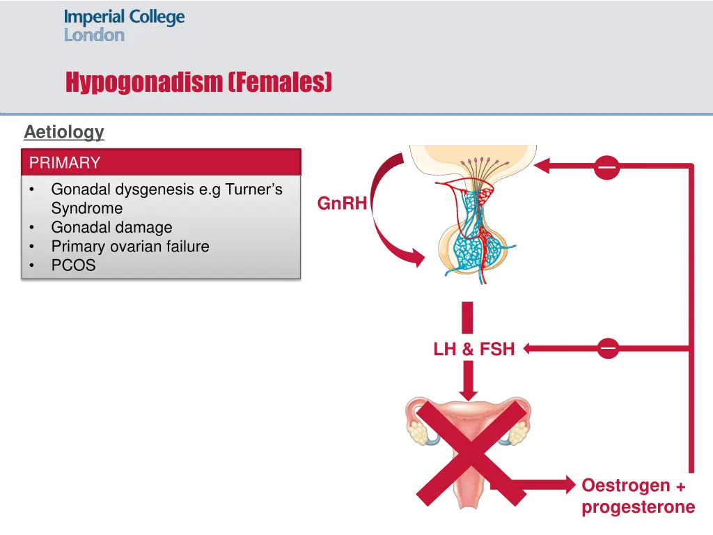 hypogonadism females 3