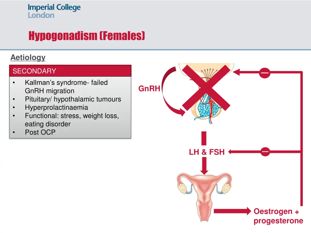 hypogonadism females 4