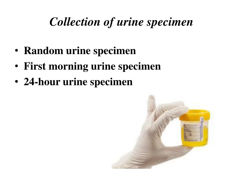 collection of urine specimen