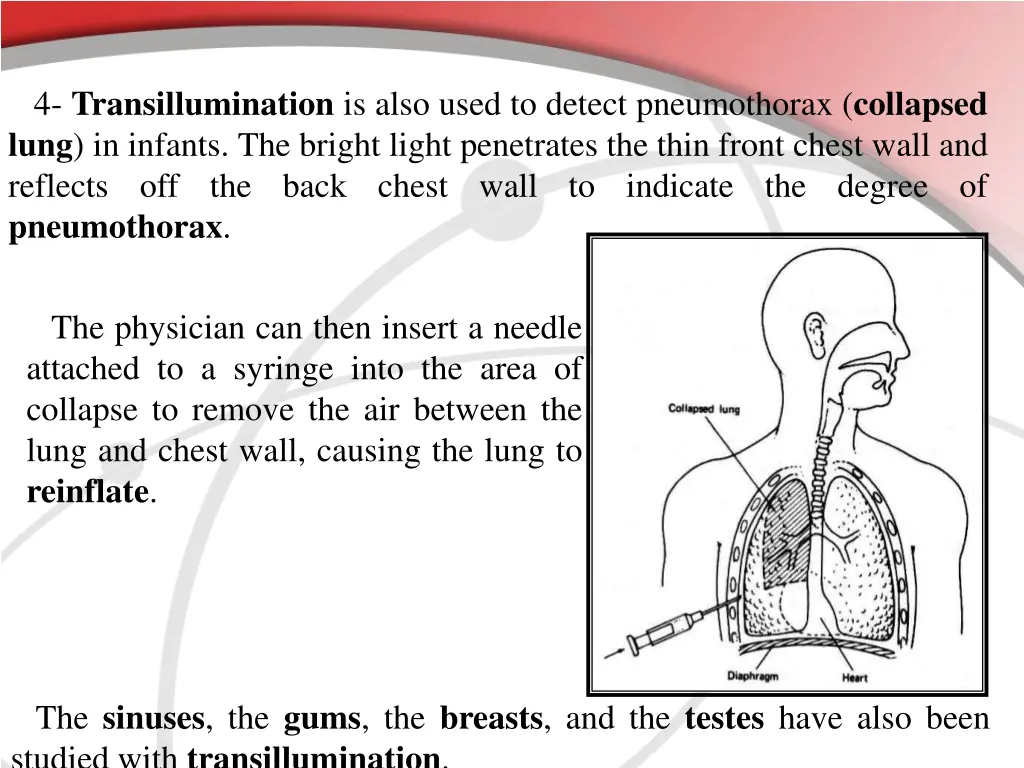 4 transillumination is also used to detect