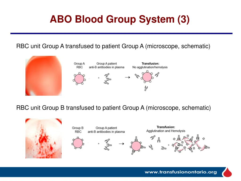 abo blood group system 3