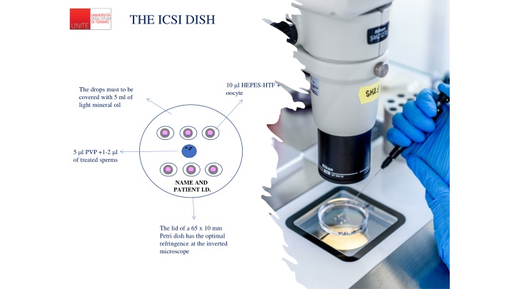 the icsi dish