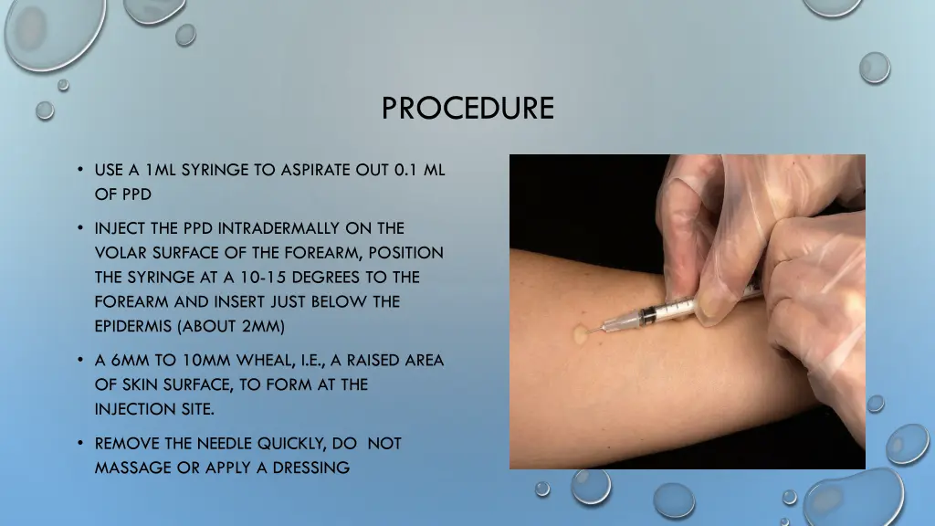 procedure