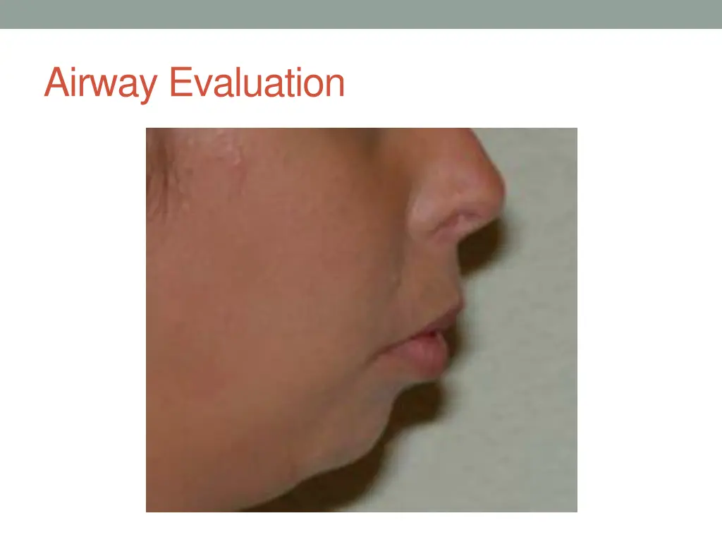 airway evaluation 1