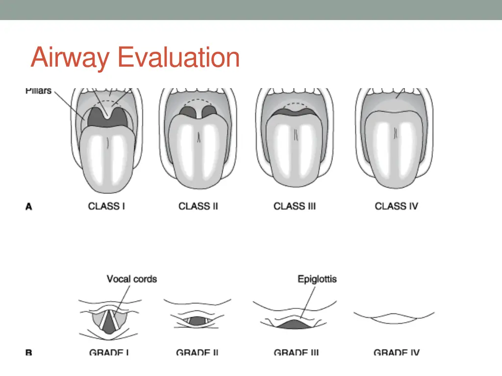 airway evaluation 4