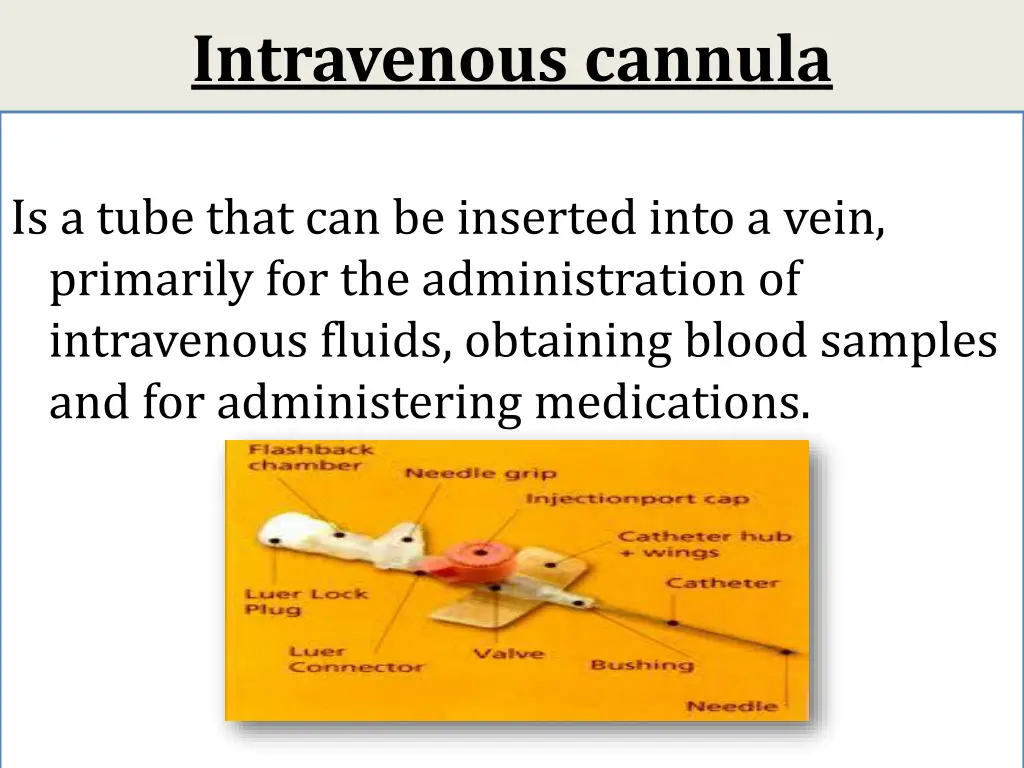 intravenous cannula