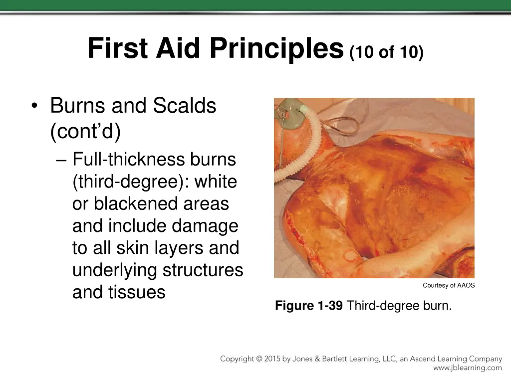 first aid principles 10 of 10