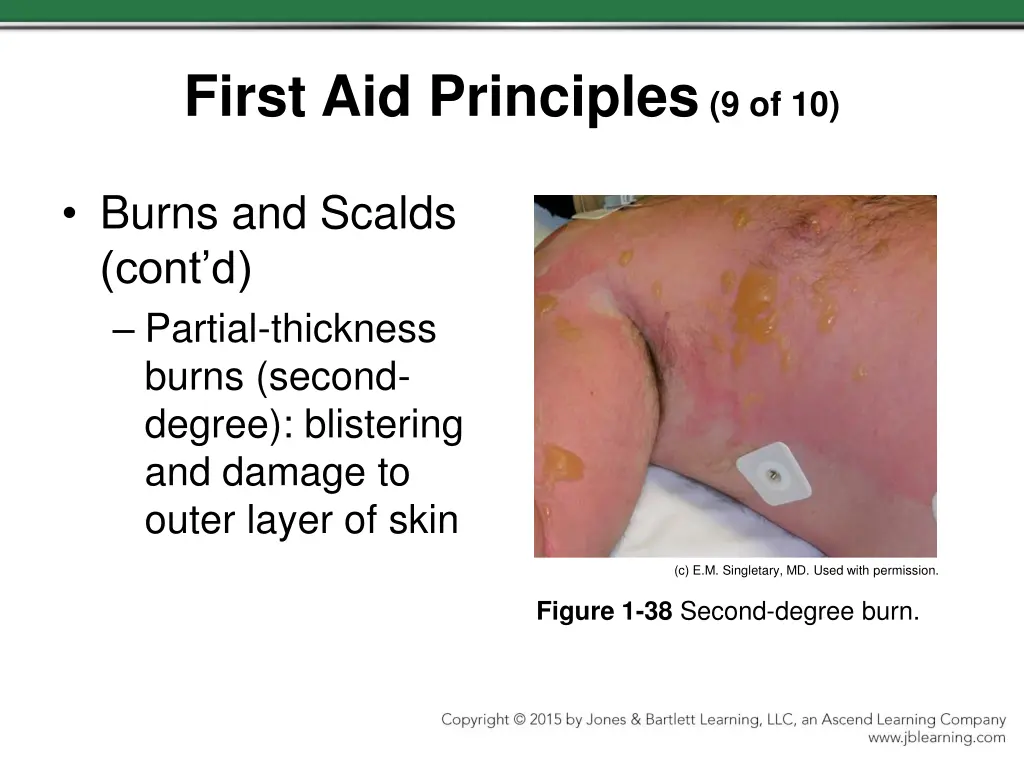 first aid principles 9 of 10