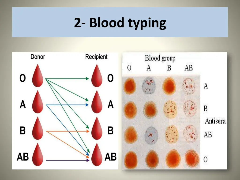 2 blood typing 2