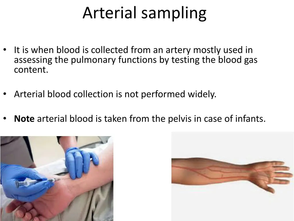 arterial sampling