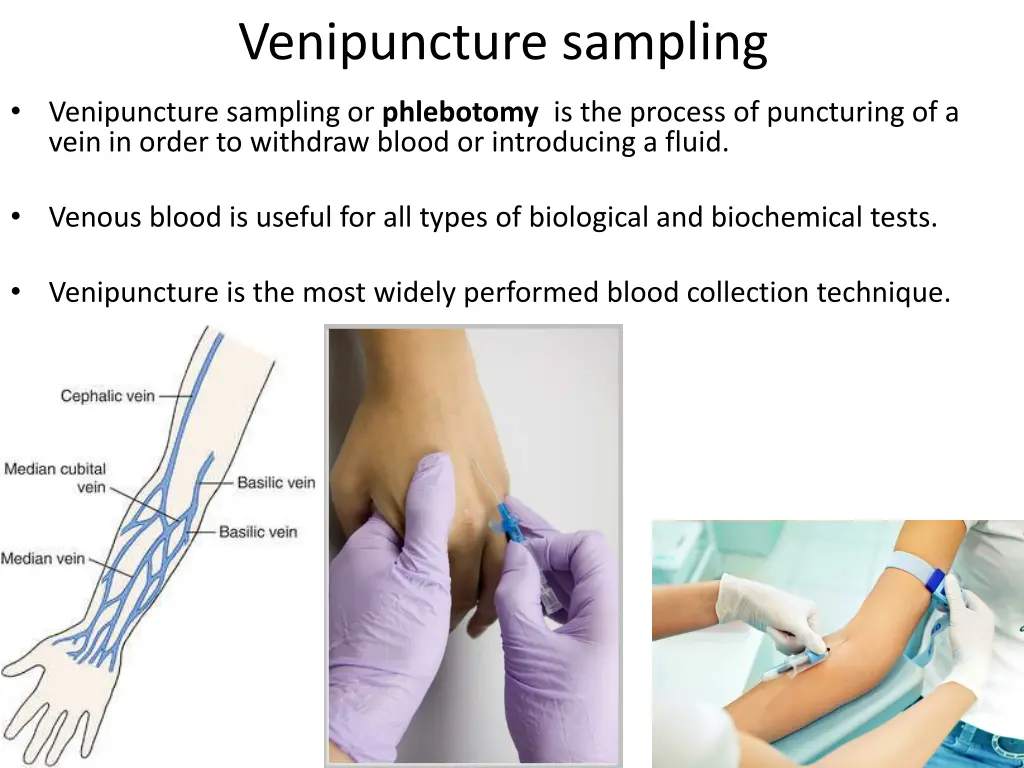 venipuncture sampling