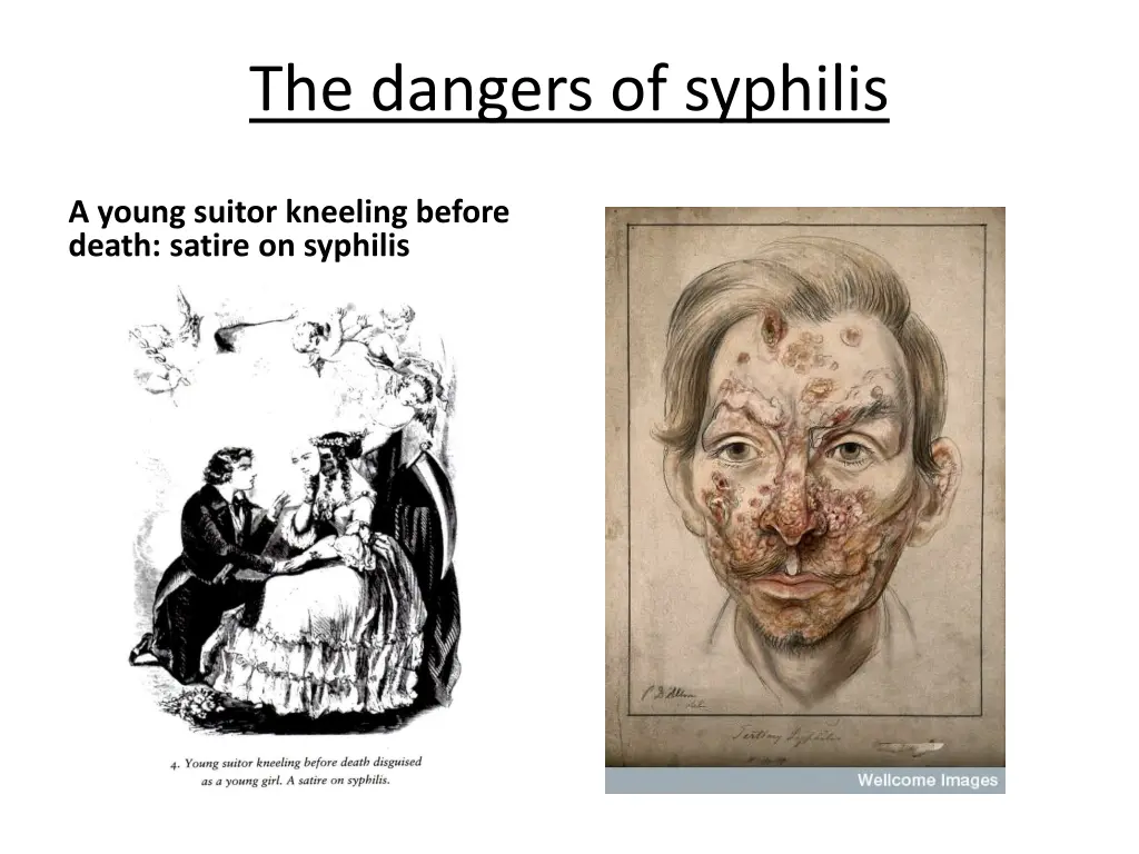 the dangers of syphilis